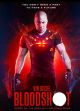Bloodshot (2020) Teljes Film Magyarul